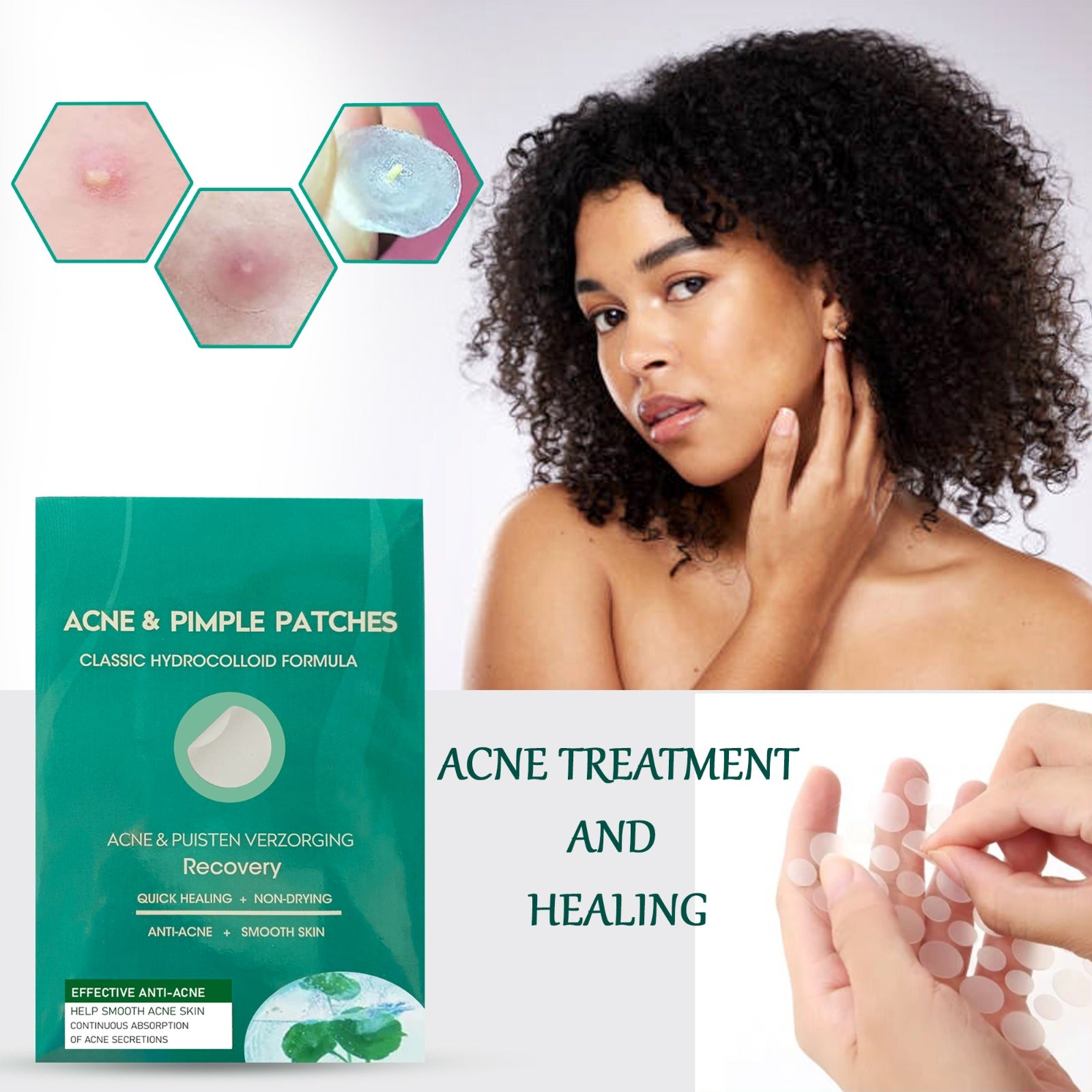 Mode Blend Acne Healing Patches displayed on a modern skincare setup, showcasing their invisible and waterproof features for effortless blemish care