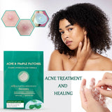 Acne Patches - Pack of 36 Translucent Hydrocolloid Pimple Patch Spot Treatment Stickers for Face and Body - Fast-Acting & Cruelty Free Skin Care - Mode Blend
