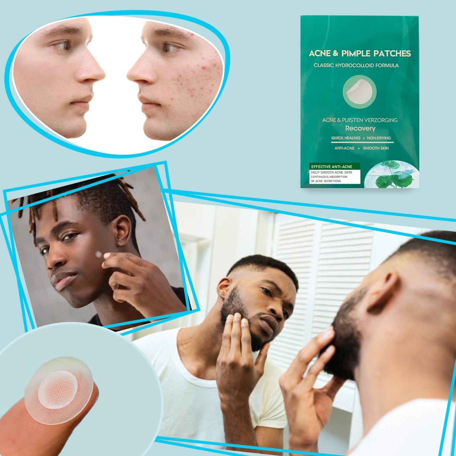 A hand holding the Mode Blend Pimple Patch pack, emphasizing its compact and easy-to-use design for on-the-go skincare