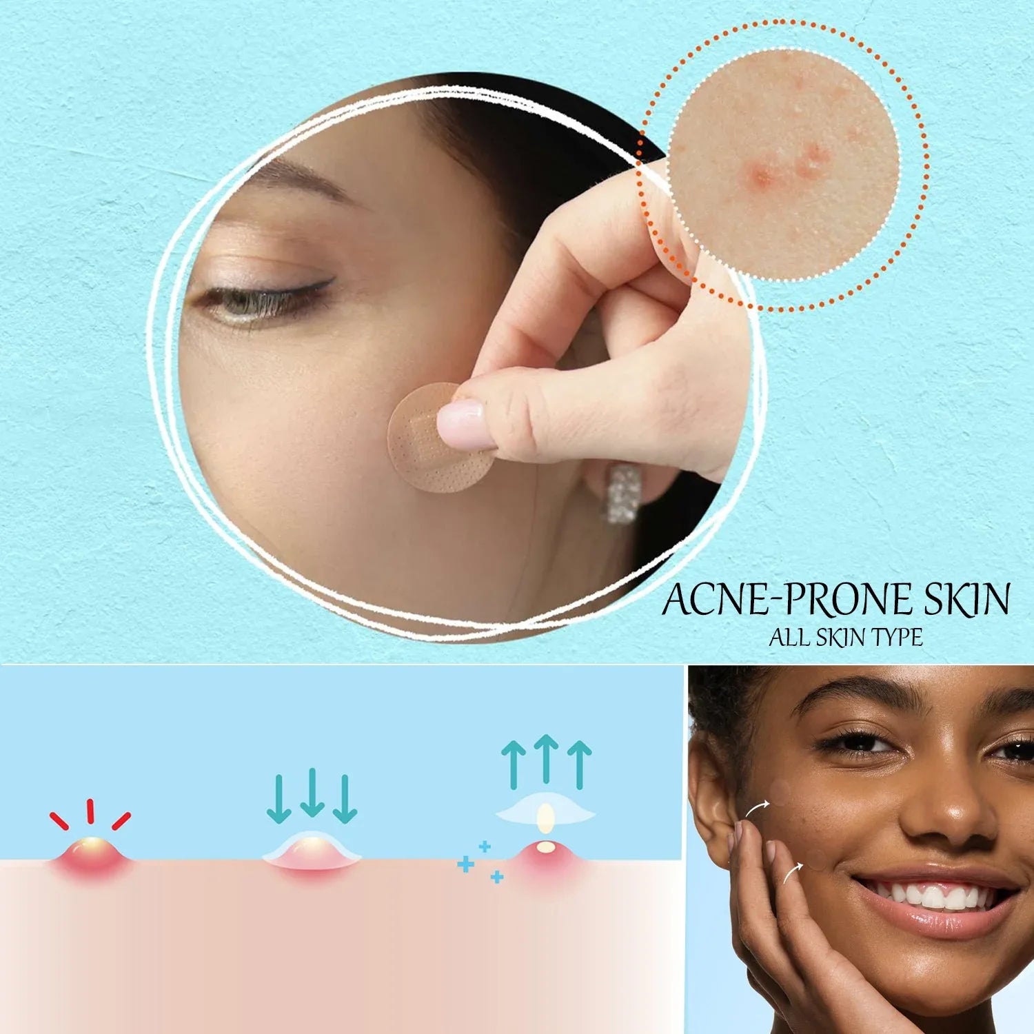 Acne Patches - Pack of 36 Translucent Hydrocolloid Pimple Patch Spot Treatment Stickers for Face and Body - Fast-Acting & Cruelty Free Skin Care - Mode Blend