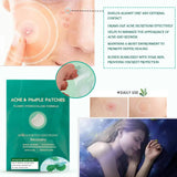 Acne Patches - Pack of 36 Translucent Hydrocolloid Pimple Patch Spot Treatment Stickers for Face and Body - Fast-Acting & Cruelty Free Skin Care - Mode Blend