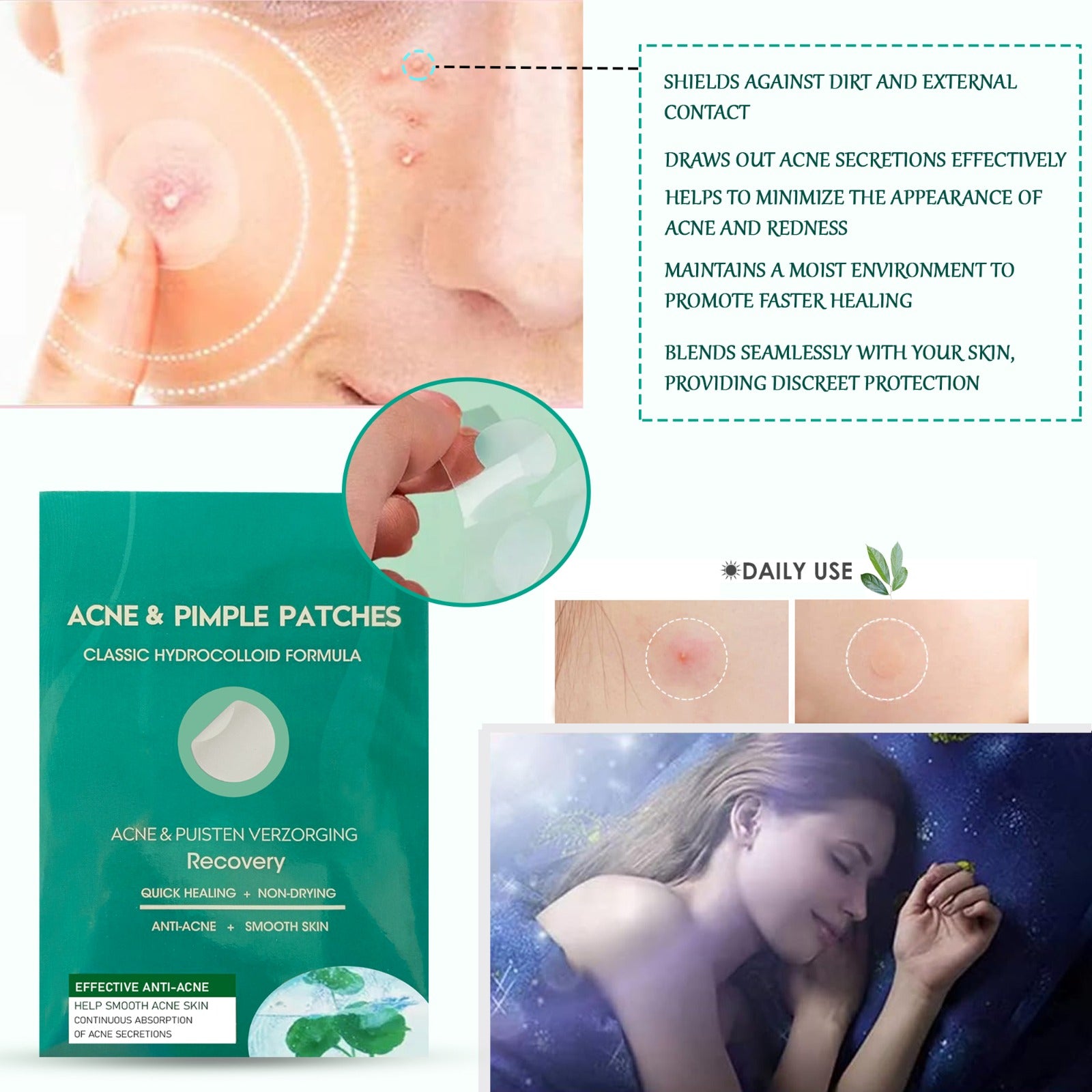 Open pack of Mode Blend Acne Patches, highlighting the variety of patch sizes for versatile skincare needs